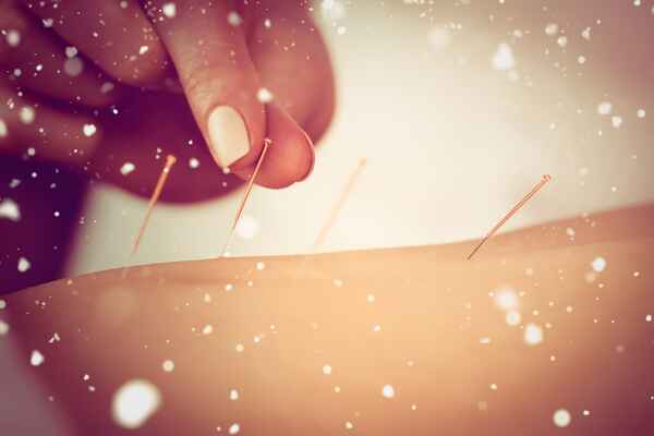 acupuncture sous la neige